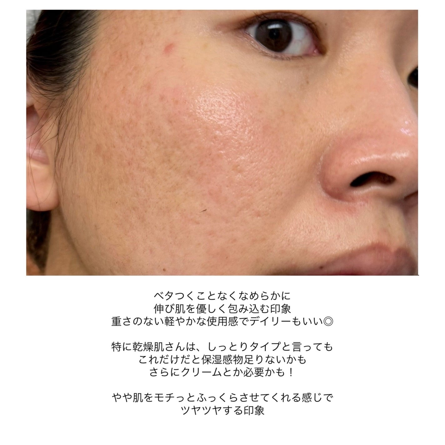 ブライトニング 化粧液 II しっとり<医薬部外品>/ファンケル/化粧水を使ったクチコミ(7枚目)