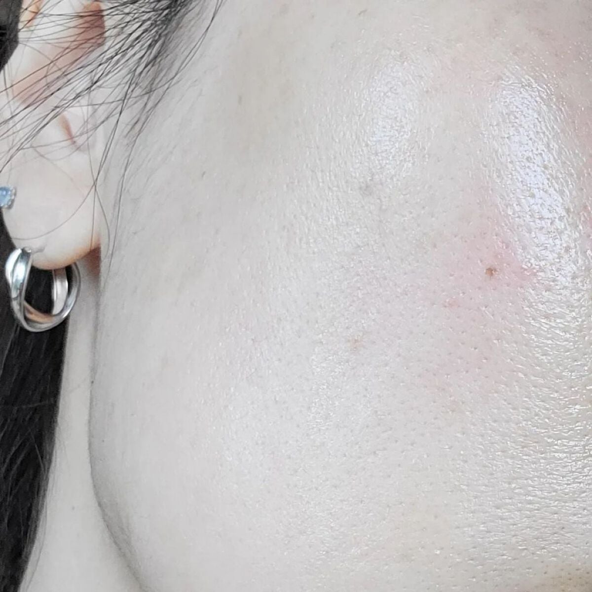 ビタペアC 集中美容液スペシャルセット/ネイチャーリパブリック/美容液を使ったクチコミ(10枚目)