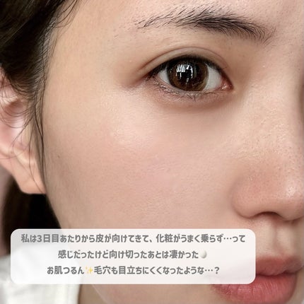 ダーマスキンピーリング/BQCELL/その他キットセットを使ったクチコミ(7枚目)