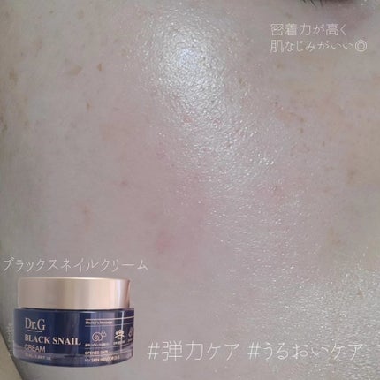 ブライトニングピーリングジェル/Dr.G/ピーリングを使ったクチコミ(5枚目)