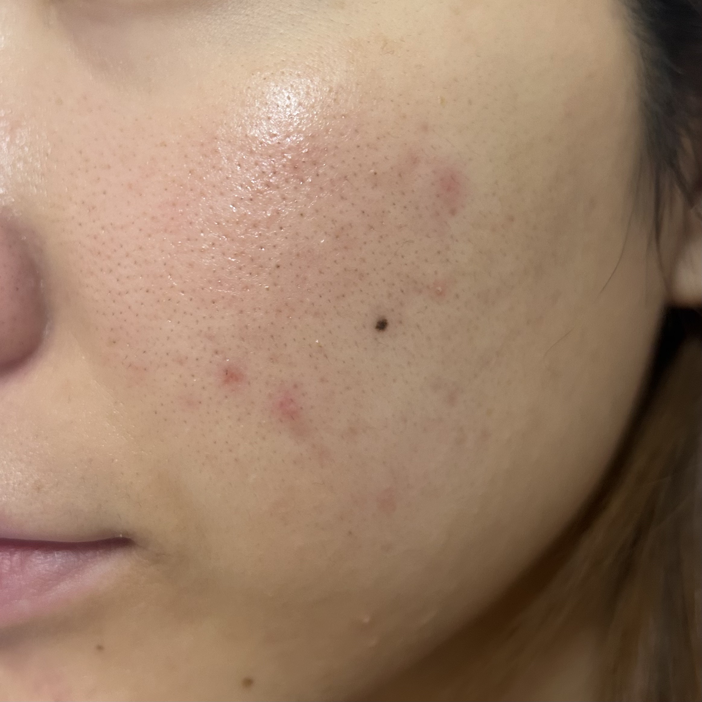 グリーンダーマCICA デイリーシートマスク 30枚(350mL)/ネイチャーリパブリック/シートマスク・パックを使ったクチコミ（2枚目）