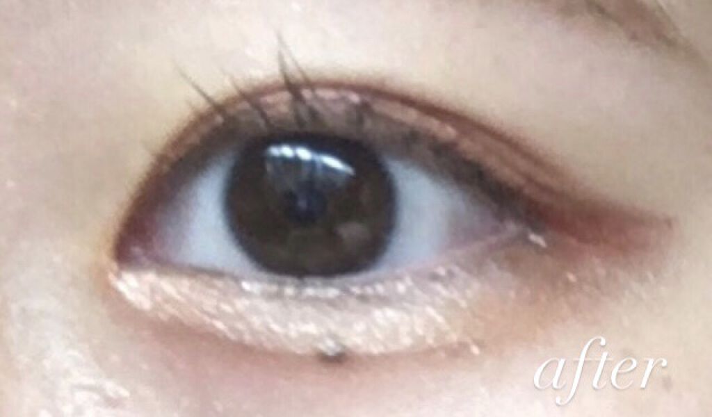 アイトーク/アイトーク/二重まぶた用アイテムを使ったクチコミ（2枚目）