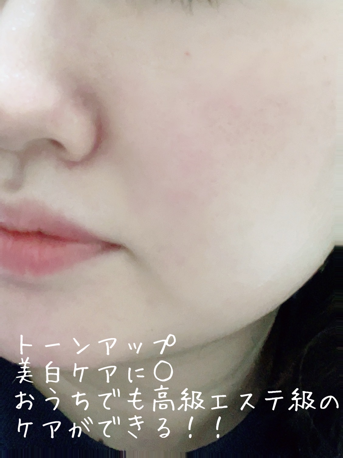 PDRNピンクアンプル PDRN 10,000ppm配合/MEDICUBE/美容液を使ったクチコミ（3枚目）