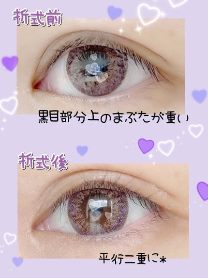 オリシキ アイリッドスキンフィルム /D-UP/二重まぶた用アイテムを使ったクチコミ(2枚目)
