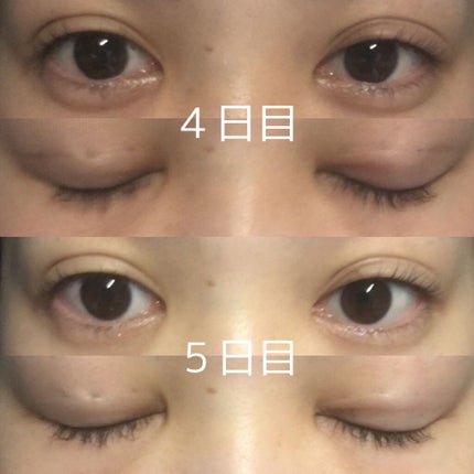 ニャルラトホテプ on LIPS 「前回アイテープで二重にする方法を投稿したばっかりですが5日1日..」(5枚目)