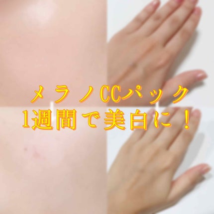 集中対策マスクMK/メラノCC/シートマスク・パックを使ったクチコミ(1枚目)