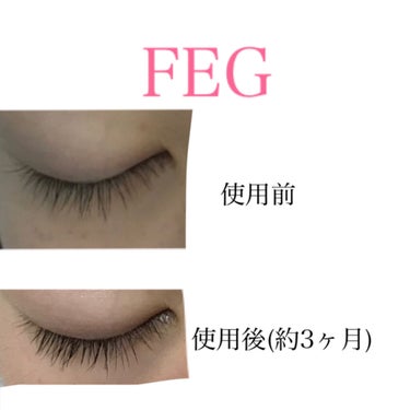 FEG  Eyelash  Enhancer/FEG/まつげ美容液を使ったクチコミ（3枚目）