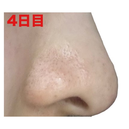 ディープクリア酵素洗顔 /メラノCC/洗顔フォームを使ったクチコミ(7枚目)