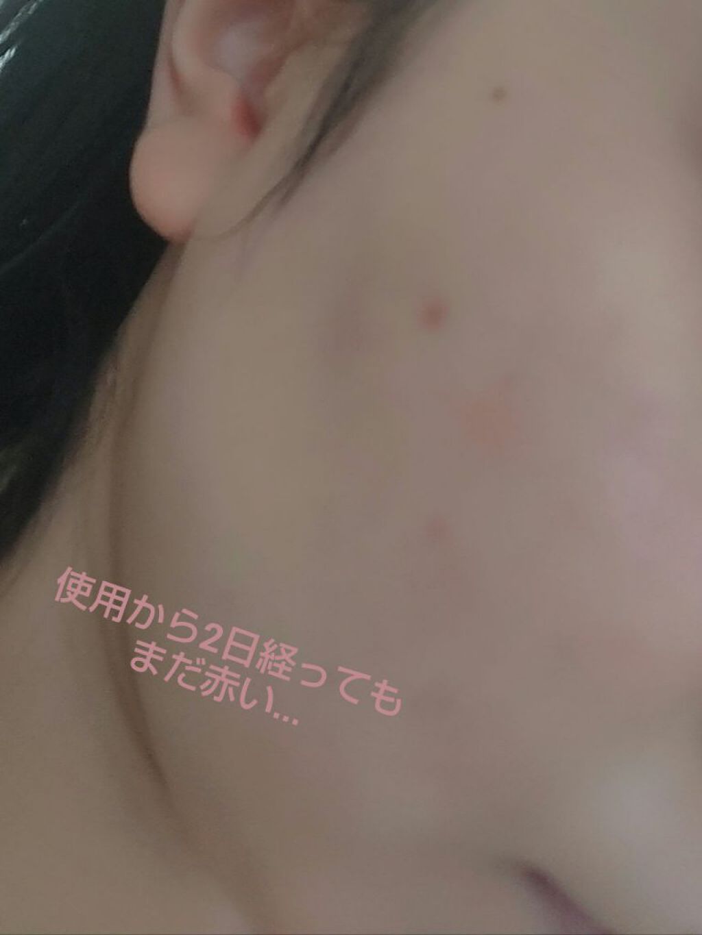 マイルド＆モイスチャーアロエジェル/ネイチャーリパブリック/ボディローションを使ったクチコミ（2枚目）