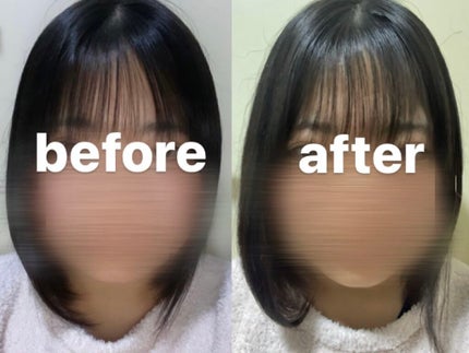 ヘアアクセルレーター レモンライムの香り/加美乃素本舗/頭皮ローションを使ったクチコミ(2枚目)