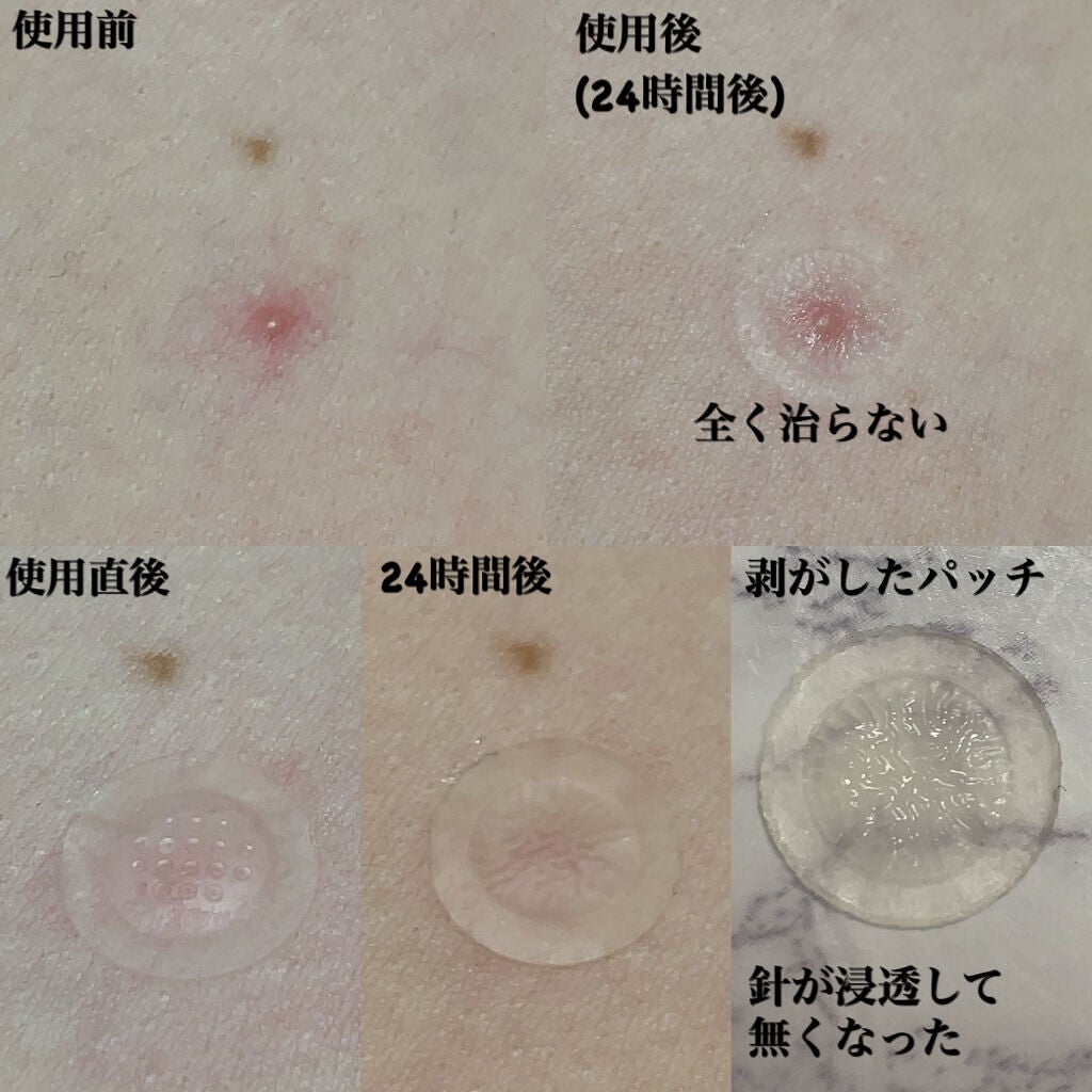 トラブルキュア/美肌ファクトリー/シートマスク・パックを使ったクチコミ(4枚目)