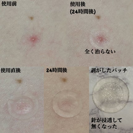 トラブルキュア/美肌ファクトリー/シートマスク・パックを使ったクチコミ(4枚目)