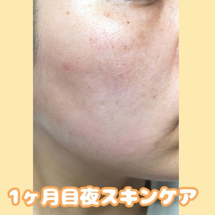 アレルバリア エッセンス BB/d プログラム/BBクリームを使ったクチコミ(4枚目)