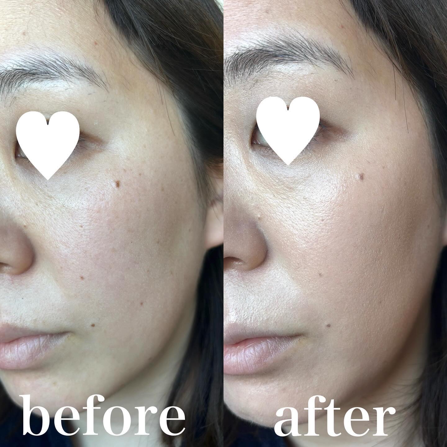 スタジオ ラディアンス セラム ファンデーション/M・A・C/リキッドファンデーションを使ったクチコミ（2枚目）