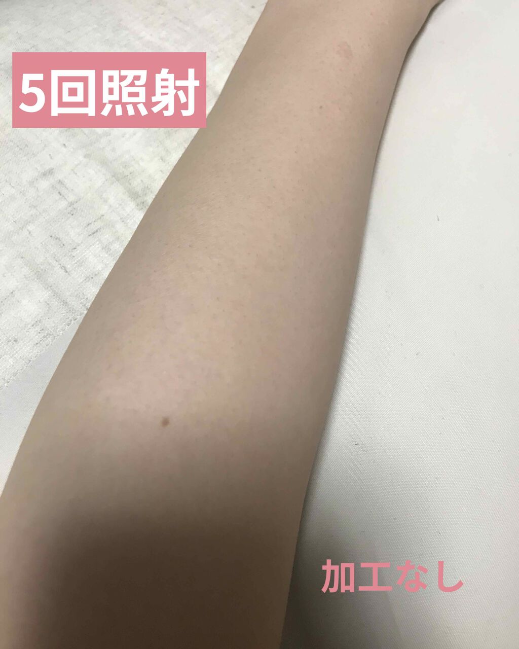 光美容器KE-NON（ケノン）/エムテック/家庭用脱毛器を使ったクチコミ（3枚目）