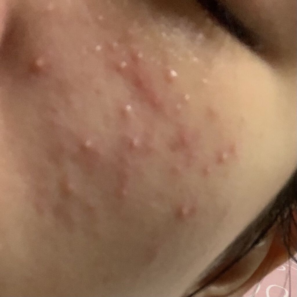 とろんと濃ジェル 薬用美白 N/なめらか本舗/オールインワン化粧品を使ったクチコミ（3枚目）