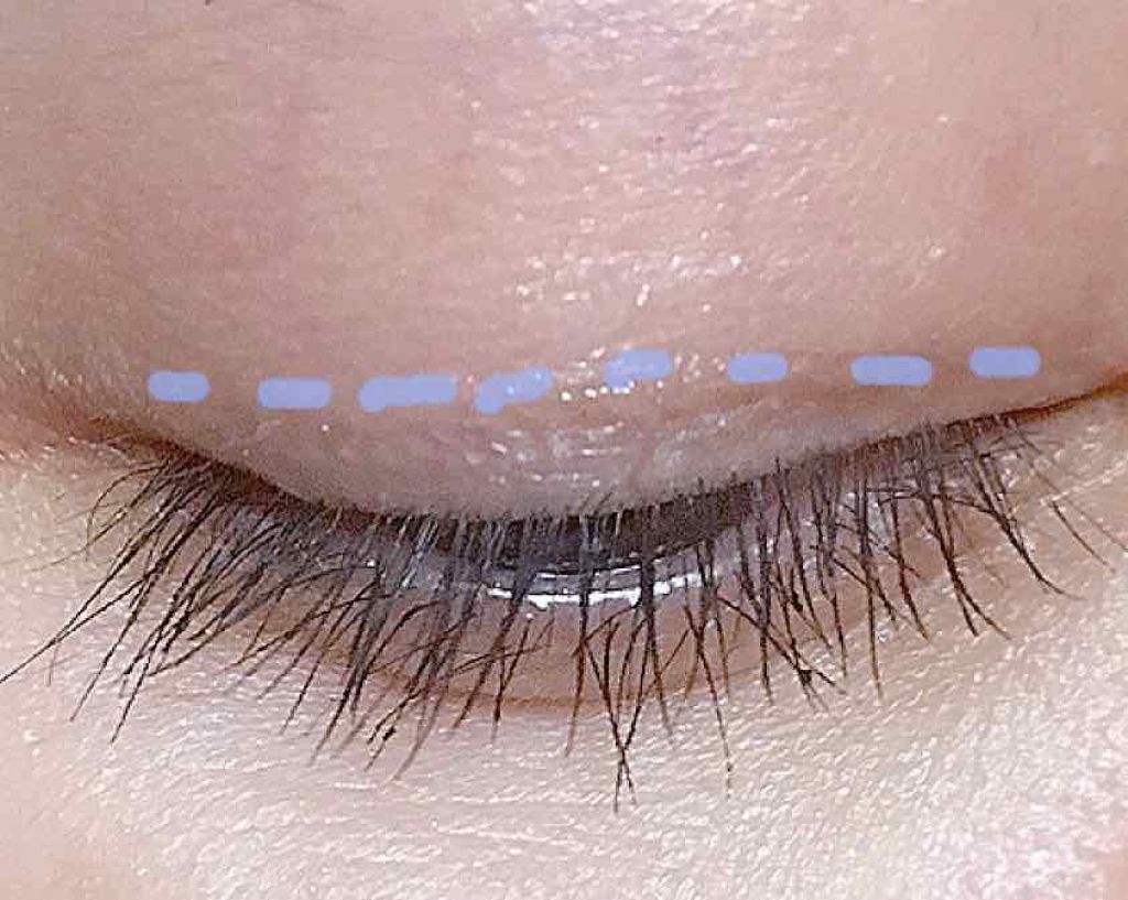 アイビューティー フィクサー WP/アストレア ヴィルゴ/二重まぶた用アイテムを使ったクチコミ（2枚目）