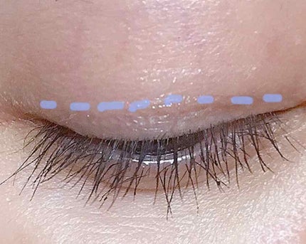 アイビューティー フィクサー WP/アストレア ヴィルゴ/二重まぶた用アイテムを使ったクチコミ(2枚目)