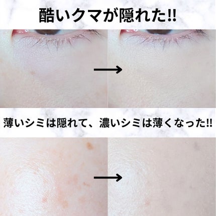 ロングラスティングチップコンシーラー/LUNA/リキッドコンシーラーを使ったクチコミ(3枚目)