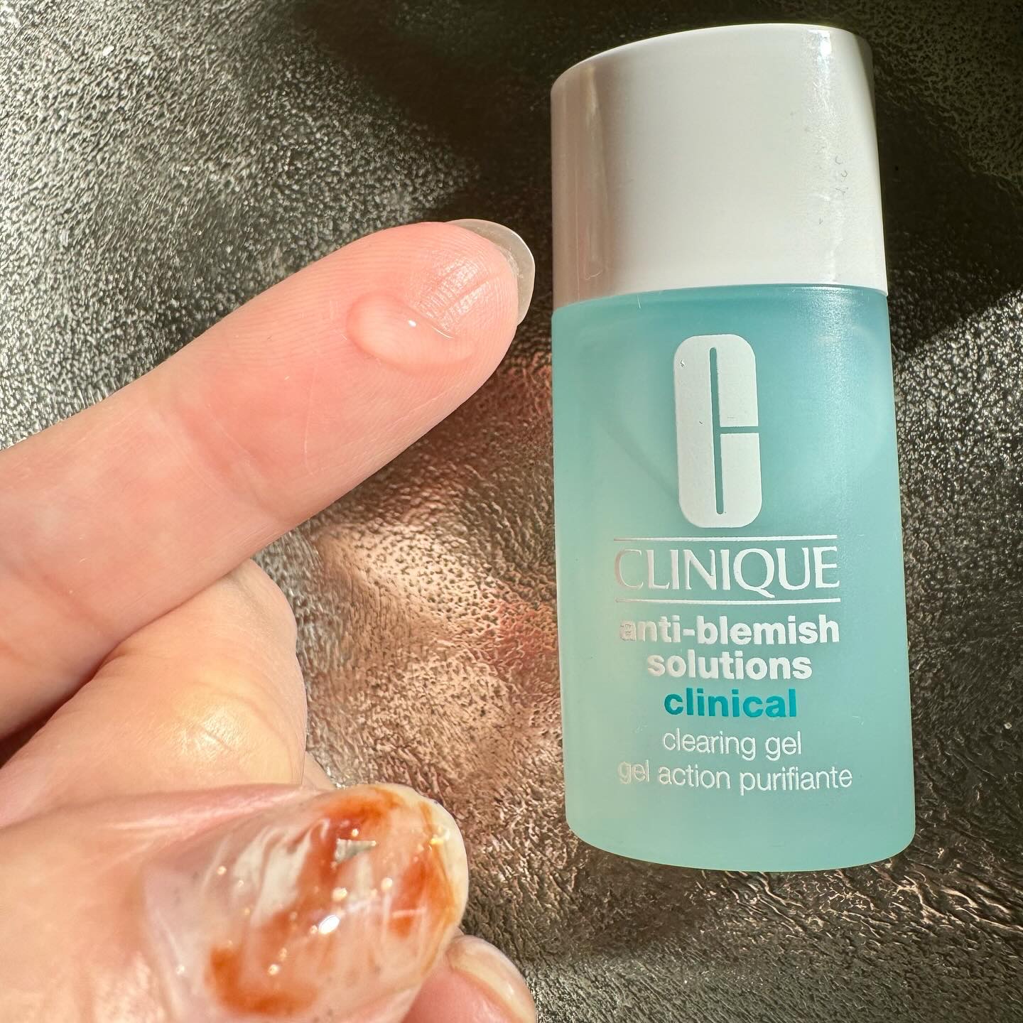 アクネ クリアリング ジェル｜CLINIQUEの口コミ - ニキビケアに