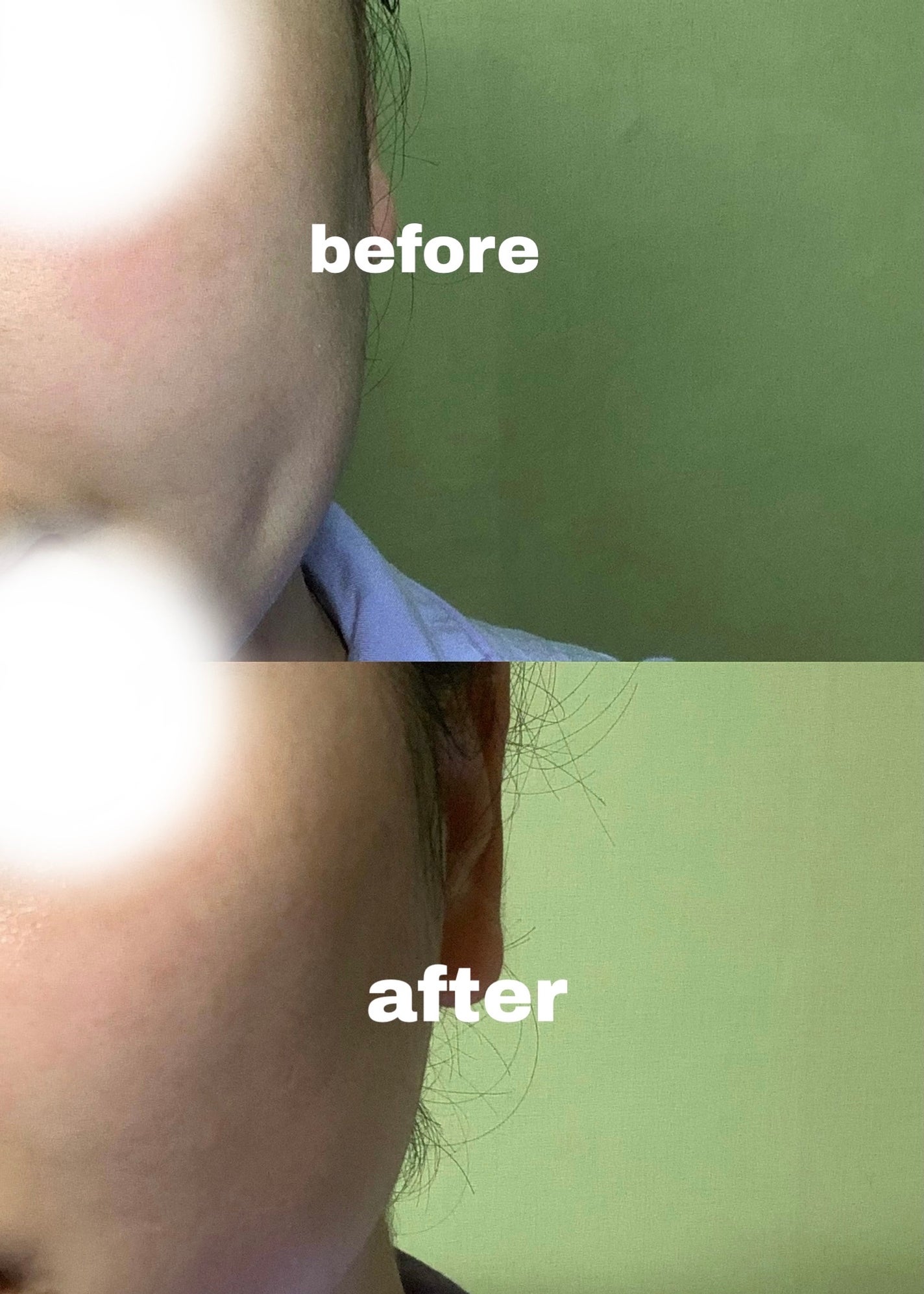 復活草ビフィダセラムファーミングドロップ/Abib /美容液を使ったクチコミ(3枚目)