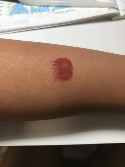 スティックプランパー エクストラセラム 01 Amber Red(アンバーレッド)/Borica/リッププランパーを使ったクチコミ(3枚目)