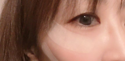 ヒッパロンL/CLEAR/その他を使ったクチコミ(4枚目)