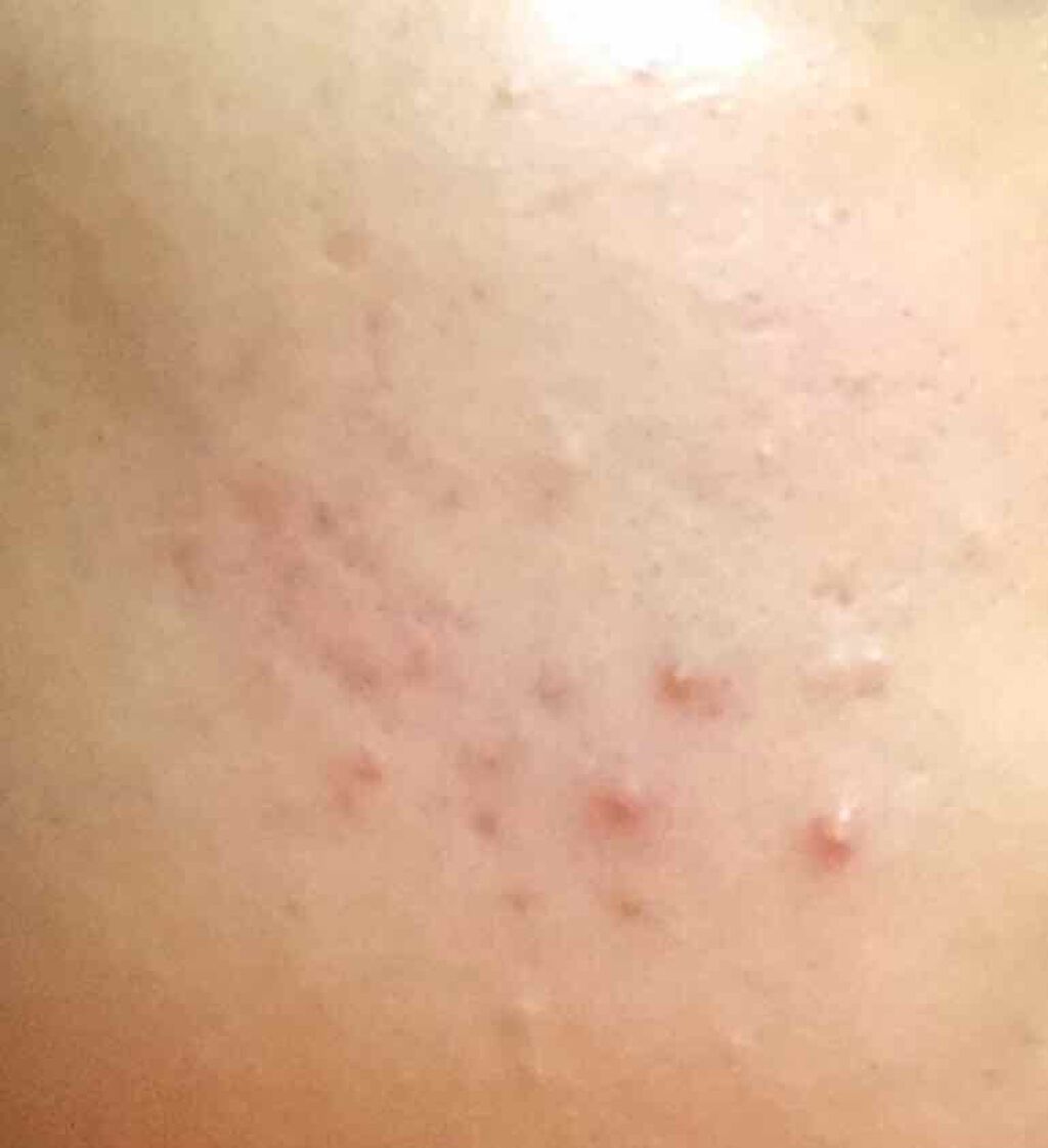 DHC はとむぎエキス/DHC/健康サプリメントを使ったクチコミ（3枚目）