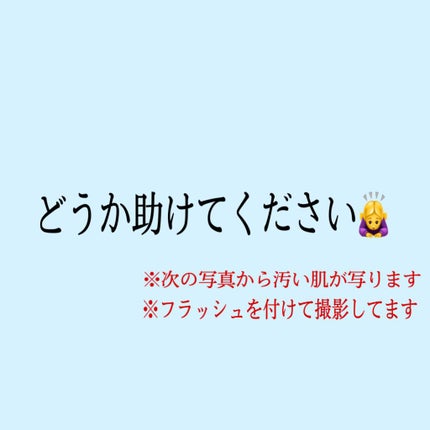 化粧水・敏感肌用・高保湿タイプ/無印良品/化粧水を使ったクチコミ(1枚目)