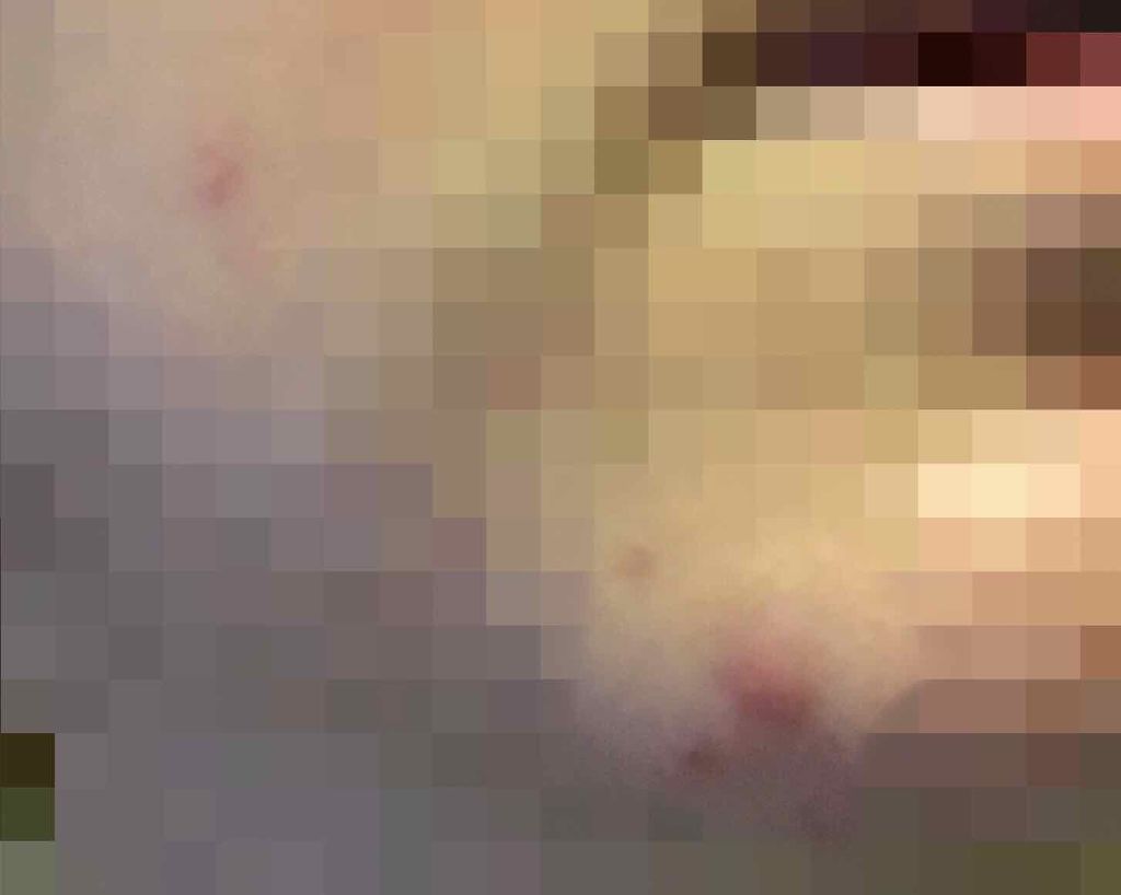 薬用 しみ 集中対策 美容液/メラノCC/美容液を使ったクチコミ（2枚目）