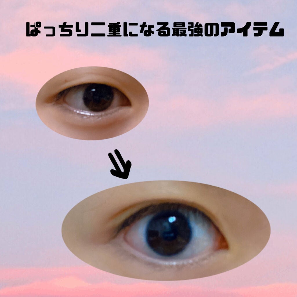 ãªãªã·ã ã¢ã€ãªããã¹ãã³ãã£ã«ã 		/D-UP/äºéãŸã¶ãçšã¢ã€ãã ã䜿ã£ãã¯ãã³ãïŒ1æç®ïŒ
