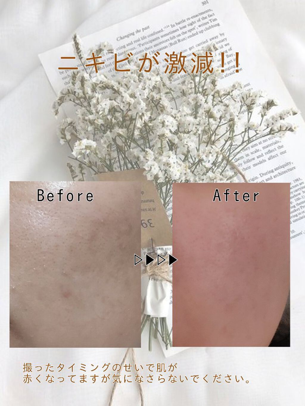 ハトムギ化粧水(ナチュリエ スキンコンディショナー R )/ナチュリエ/化粧水を使ったクチコミ（1枚目）