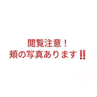 スーパー毛穴ローション/ラボラボ/化粧水を使ったクチコミ（2枚目）