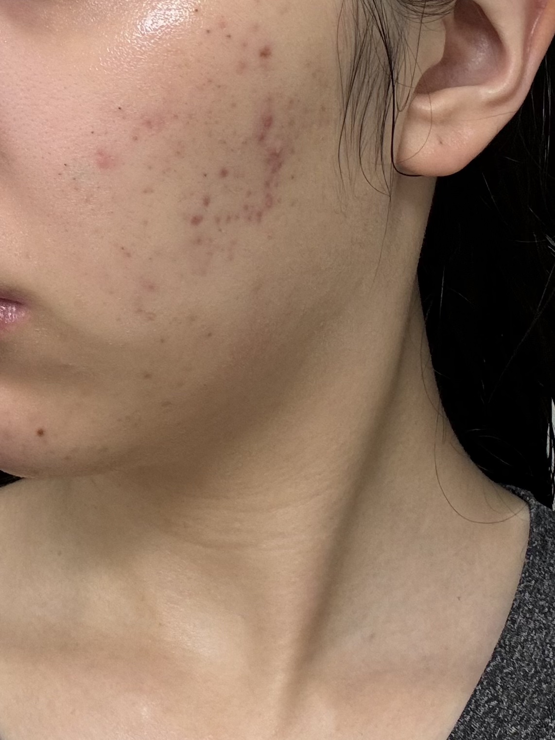 浸透湿潤セラミド１０％★ナノエマルジョン/TOUT VERT/乳液を使ったクチコミ（2枚目）