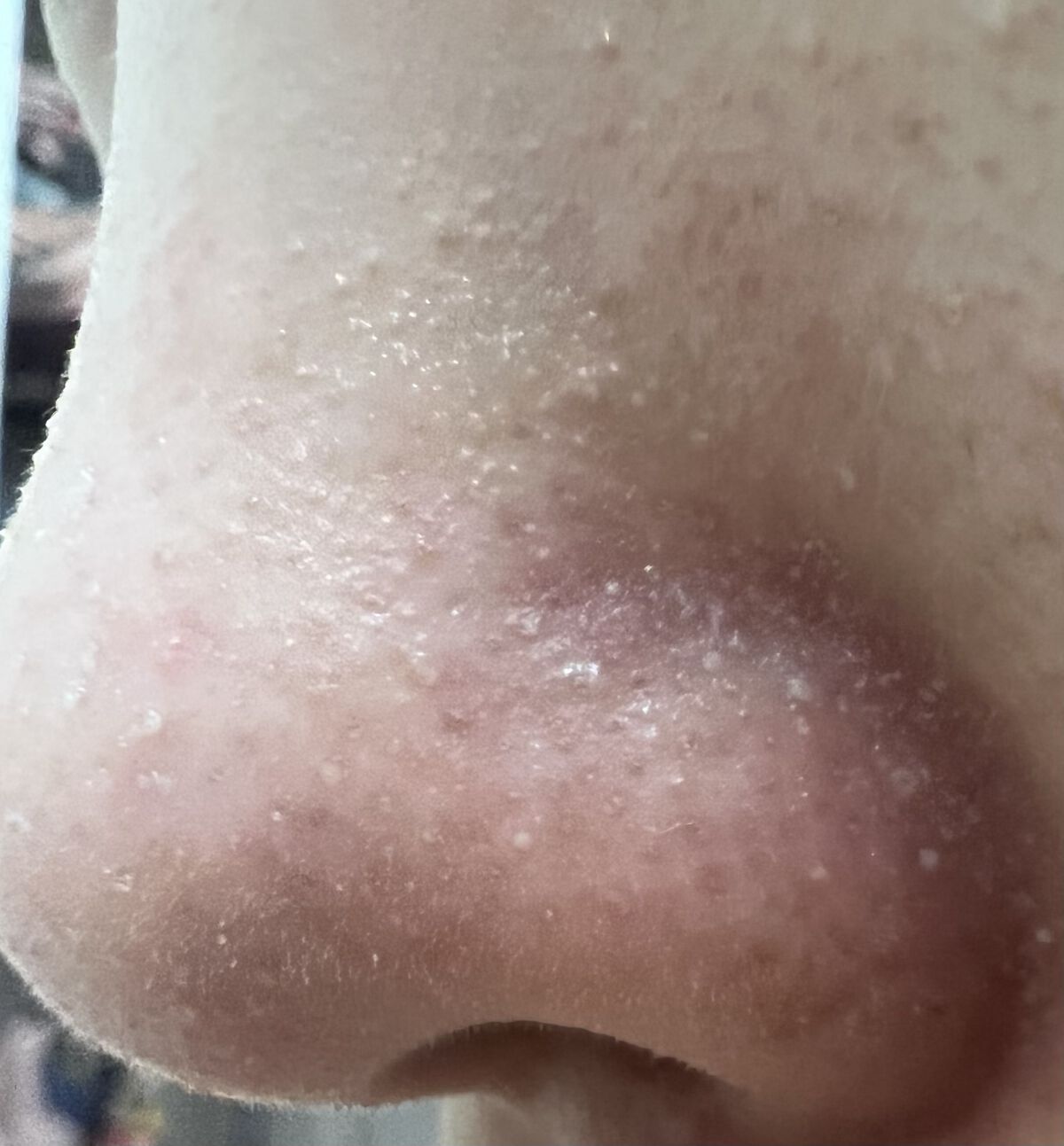 ハトムギ化粧水(ナチュリエ スキンコンディショナー R )/ナチュリエ/化粧水を使ったクチコミ（2枚目）