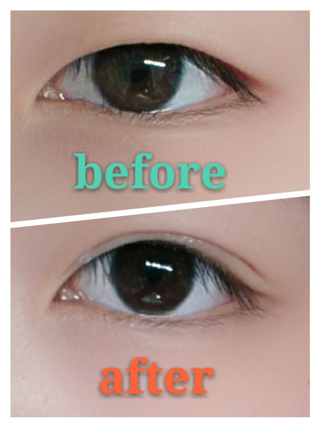 【旧品】オリシキ アイリッドスキンフィルム/D-UP/二重まぶた用アイテムを使ったクチコミ（1枚目）