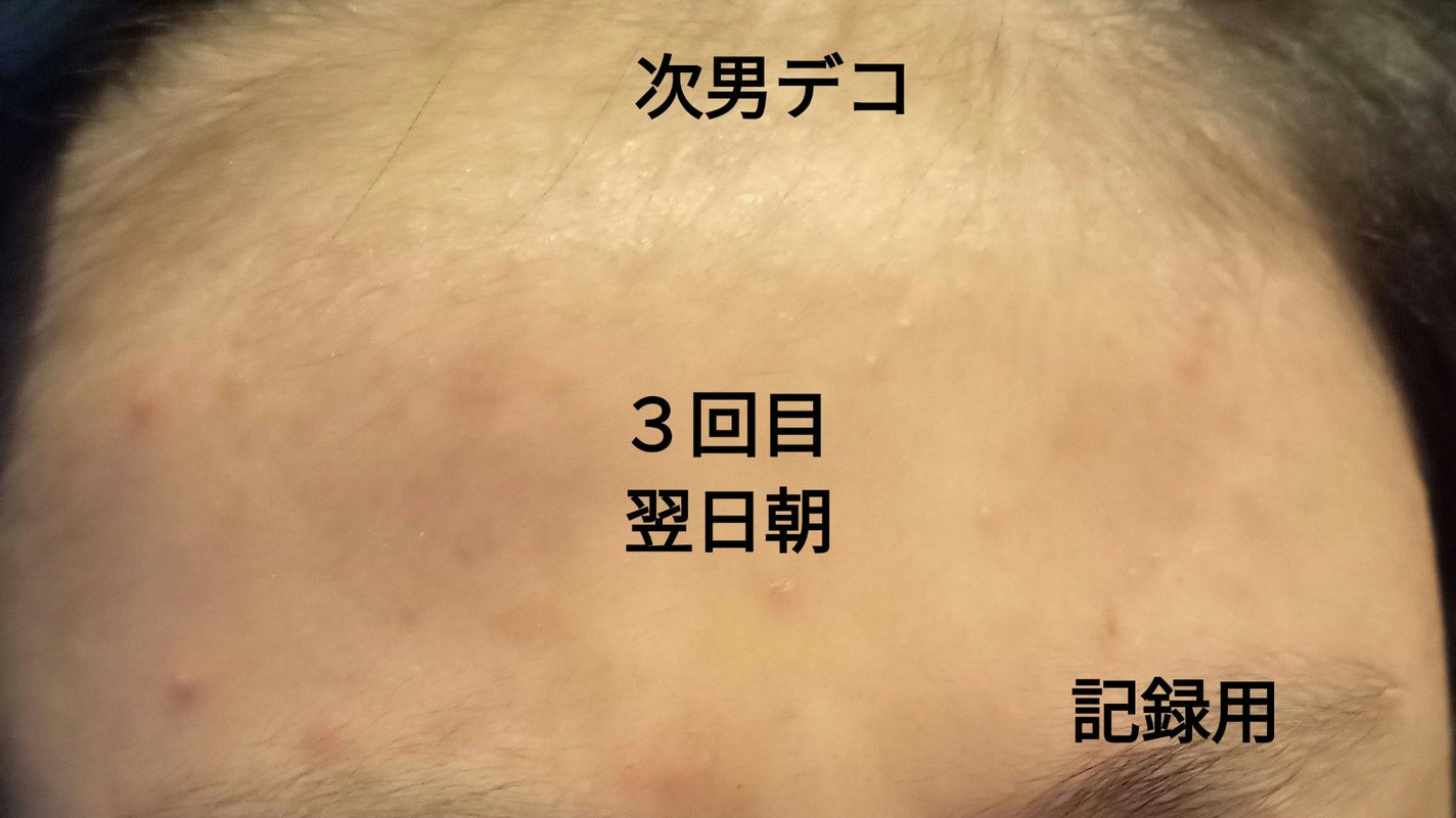 ナチュラルパック /MIRANAL/洗い流すパック・マスクを使ったクチコミ(4枚目)