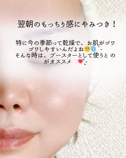 ワイルドローズビューティバーム/ニールズヤード レメディーズ/フェイスバームを使ったクチコミ(5枚目)