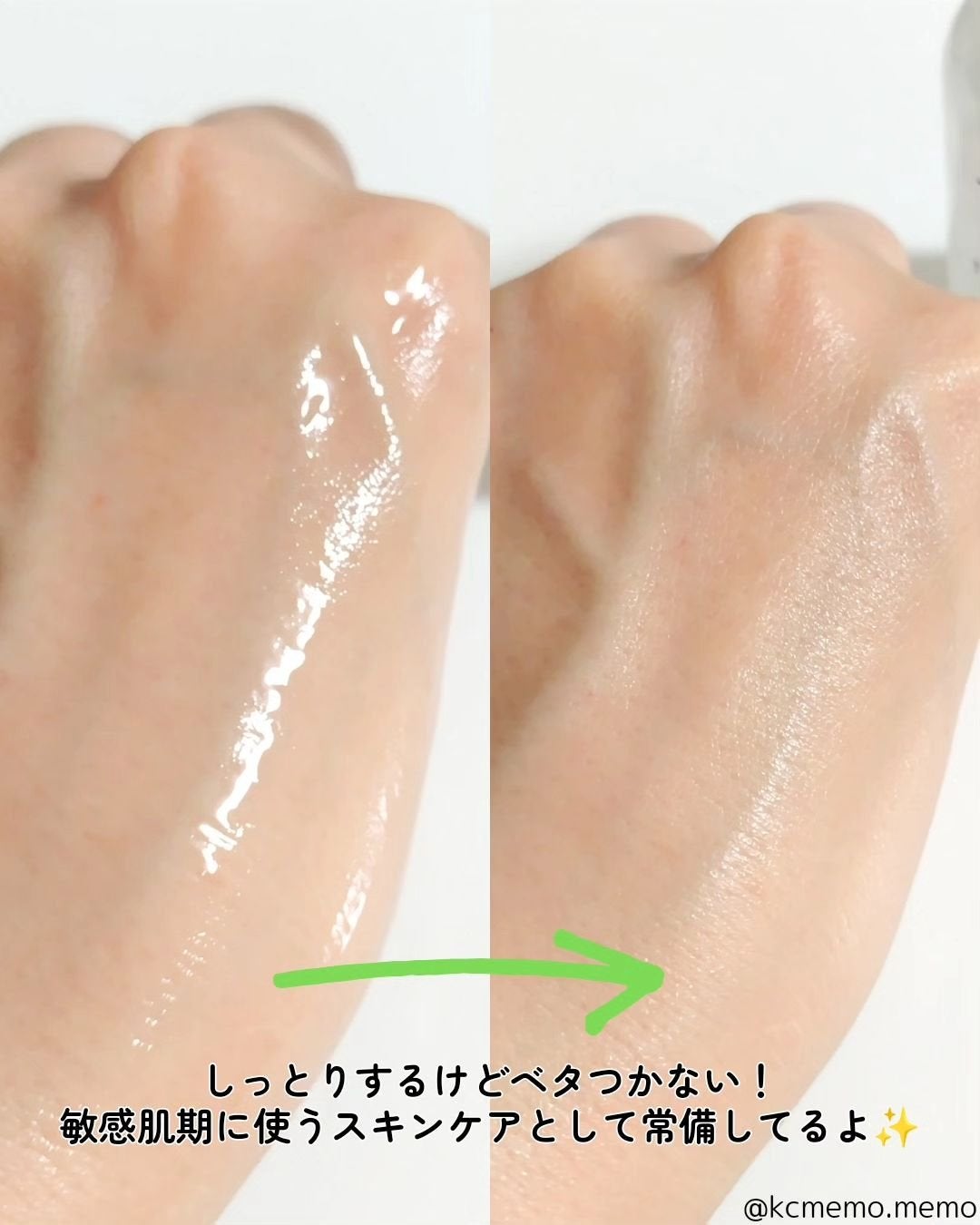 ノスカナイン トラブル セラム/FATION/美容液を使ったクチコミ(4枚目)