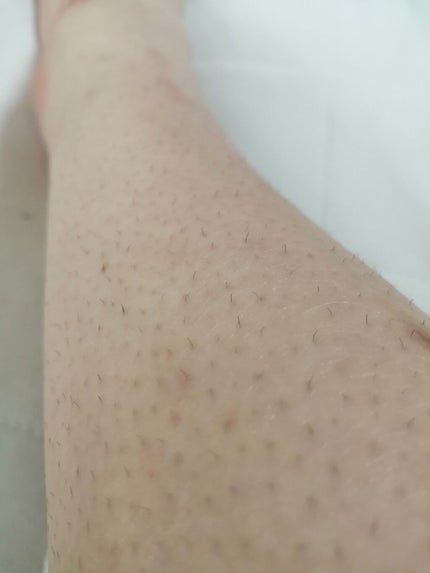 ハトムギ化粧水(ナチュリエ スキンコンディショナー R )/ナチュリエ/化粧水を使ったクチコミ(2枚目)