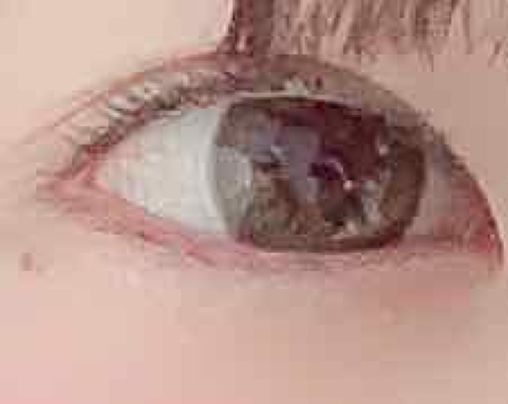 バンビシリーズ ワンデー ナチュラル/AngelColor/ワンデー(1DAY)カラコンを使ったクチコミ(2枚目)