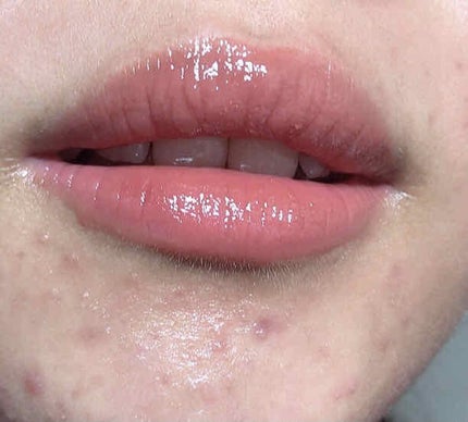 つやぷるリップR/b idol/口紅を使ったクチコミ(4枚目)