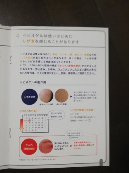 RI♡ on LIPS 「ベピオゲル医薬品ニキビが酷いから皮膚科へ赤みは少なくなったけど..」(6枚目)