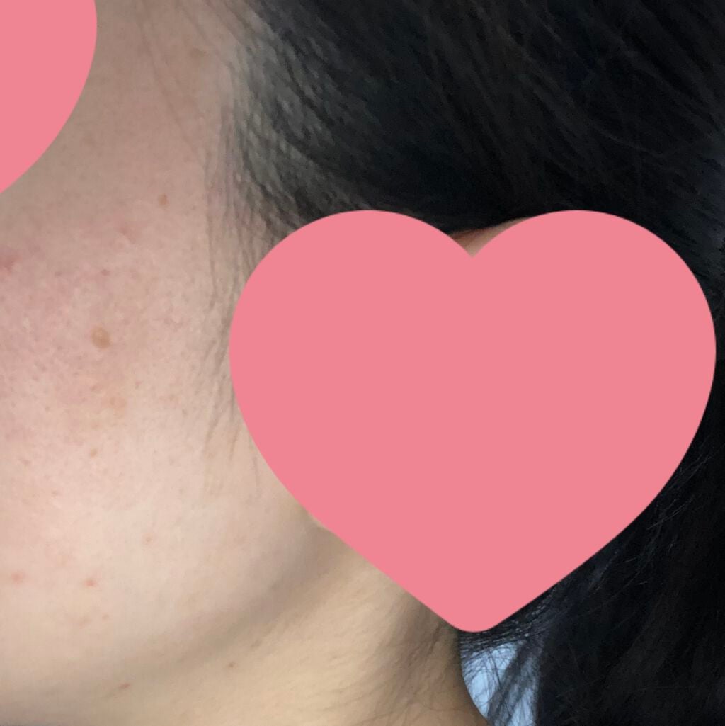 メラノショット ホワイト D/ONE BY KOSE/美容液を使ったクチコミ(2枚目)