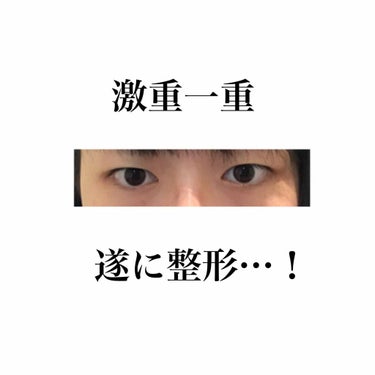 激重一重マン、ついに整形…！

〜前置き〜
日々のアイプチに疲れ果て向かった先は美容形成外科！
埋没したいです！というものの長年のアイプチにより皮膚が伸びきってて埋没じゃあ無理！切開するしかないといわれ