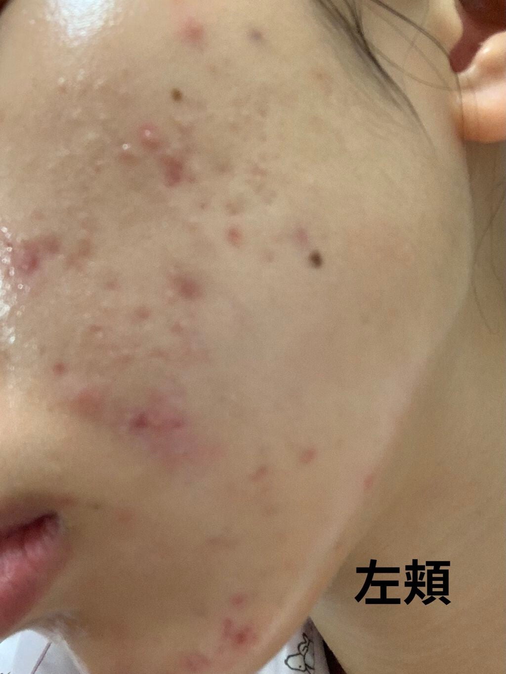 ミノン アミノモイスト モイストチャージ ミルク/ミノン/乳液を使ったクチコミ(6枚目)