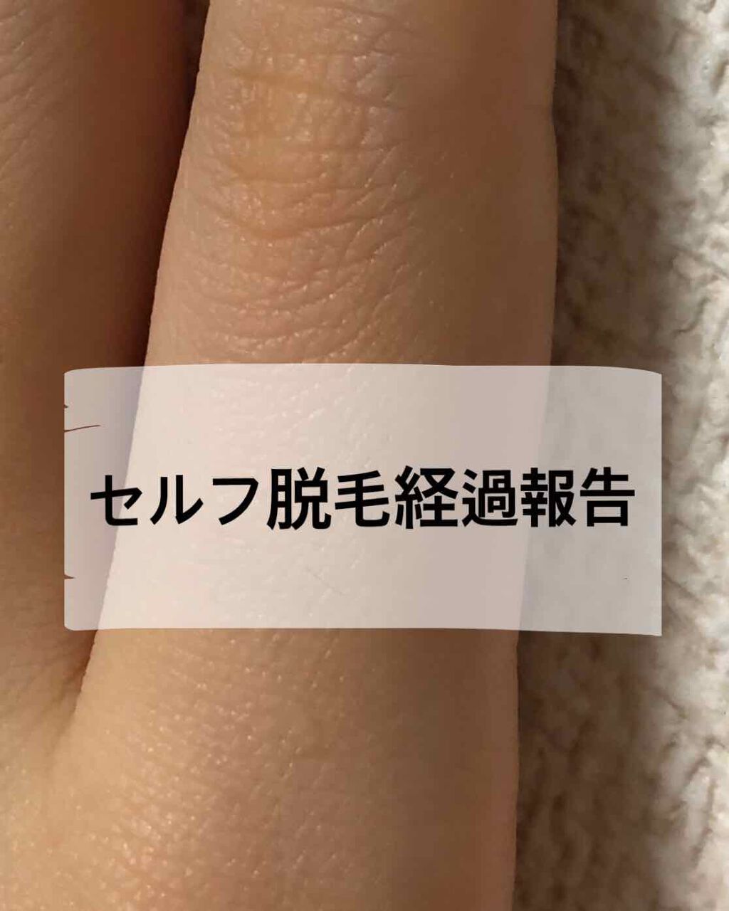 FASIZ607C IPL光脱毛器/FASIZ/家庭用脱毛器を使ったクチコミ(1枚目)