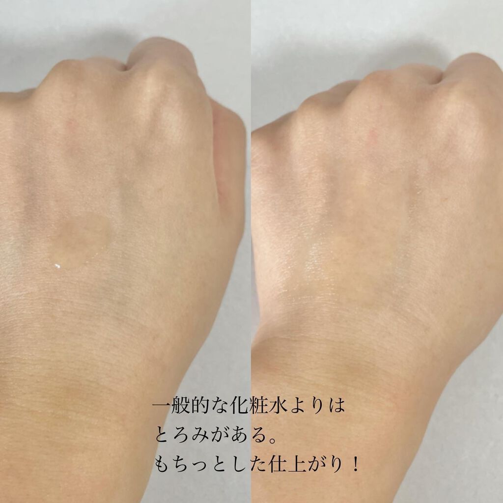 フルフィットプロポリスシナジートナー/COSRX/化粧水を使ったクチコミ(3枚目)