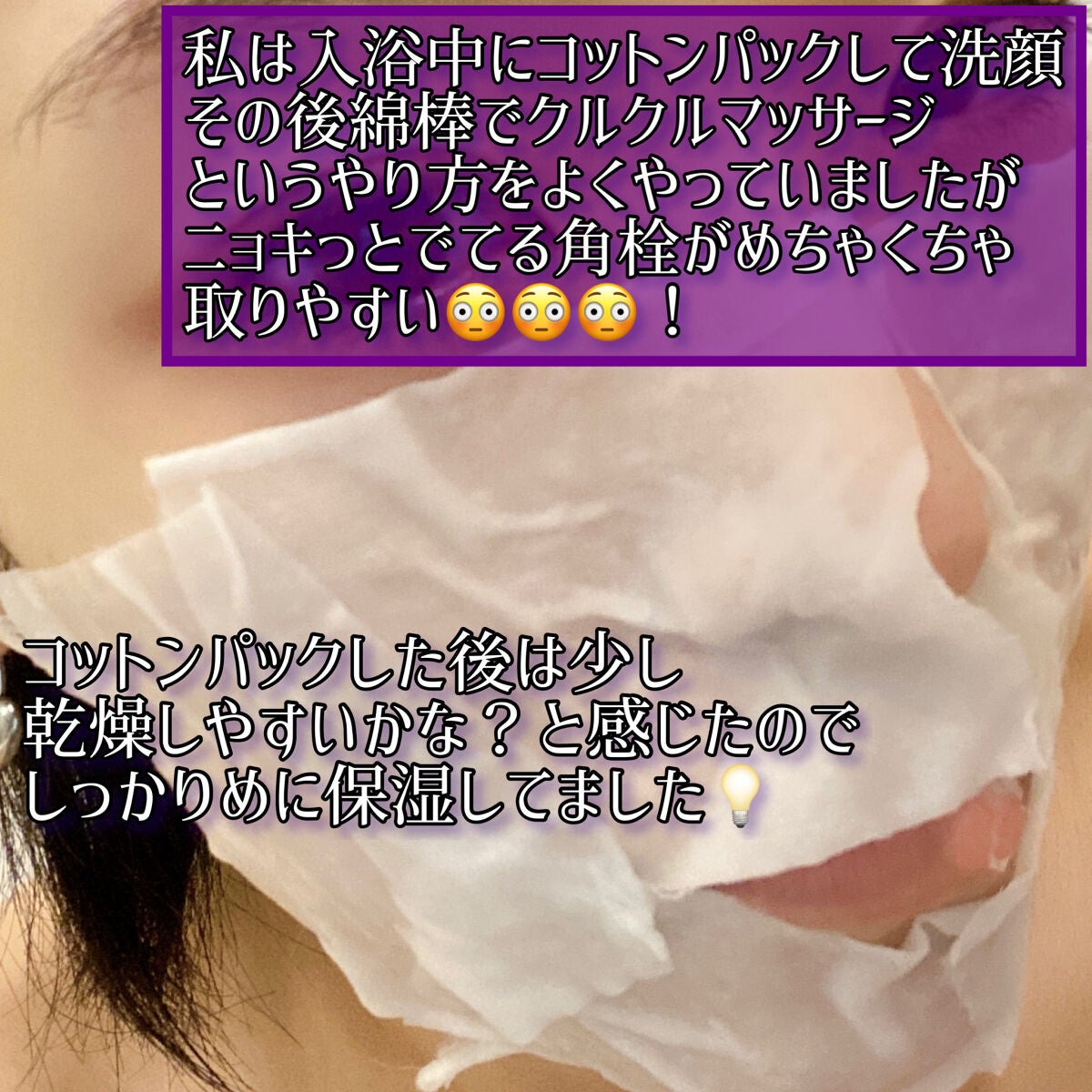 アクレオンセボエクストラクター/ANACIS/その他スキンケアを使ったクチコミ(3枚目)