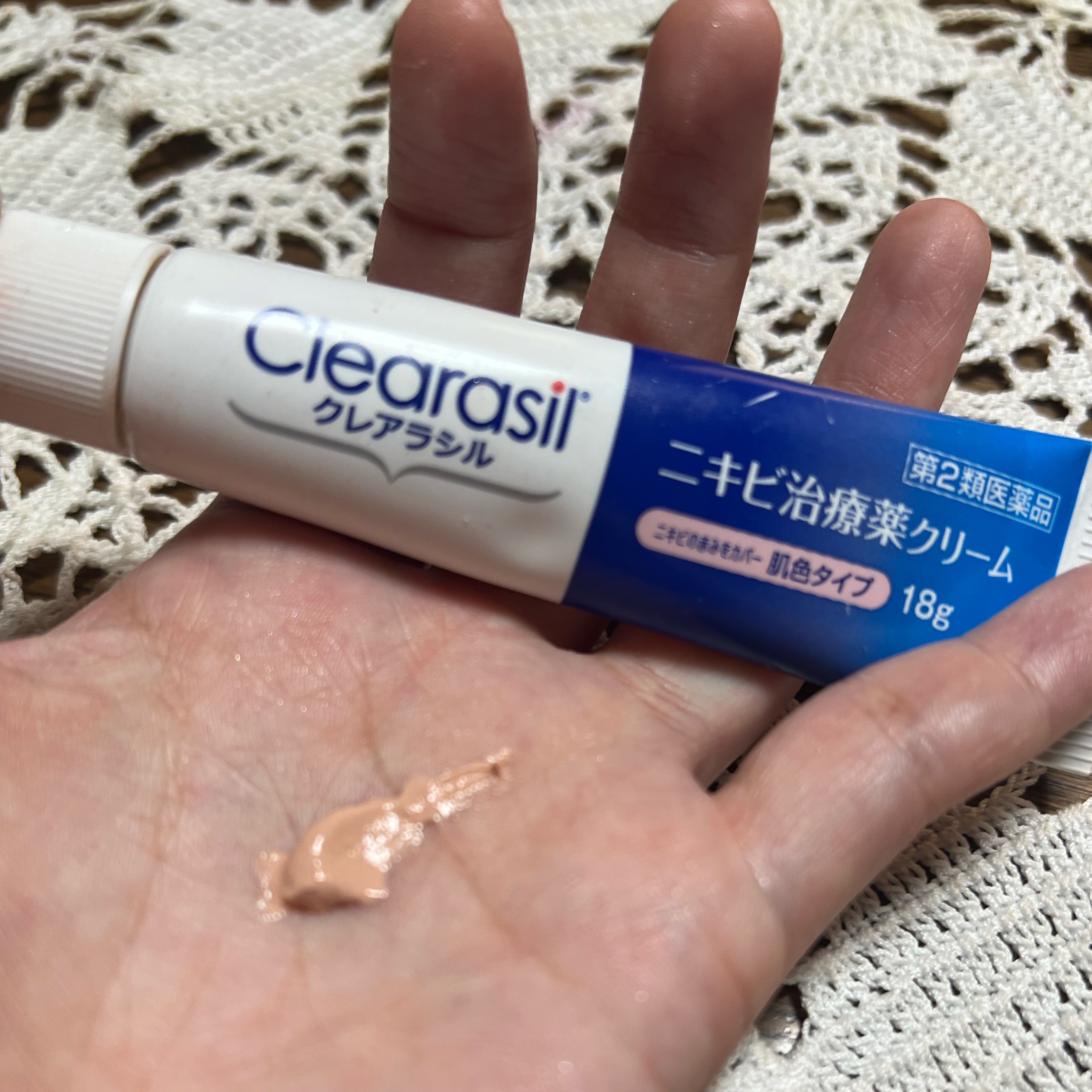 ニキビ治療薬クリーム (医薬品) 肌色/クレアラシル/その他を使ったクチコミ（2枚目）